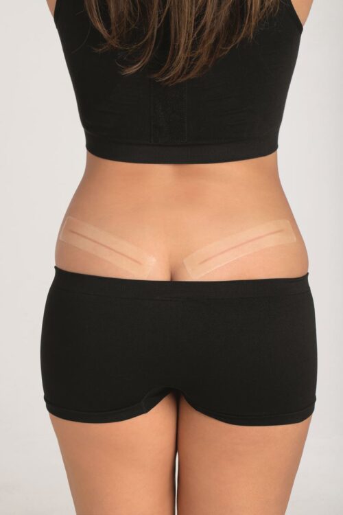 Amoena- 010 Strips Belly/Thigh Silicone Scar Patch Clear