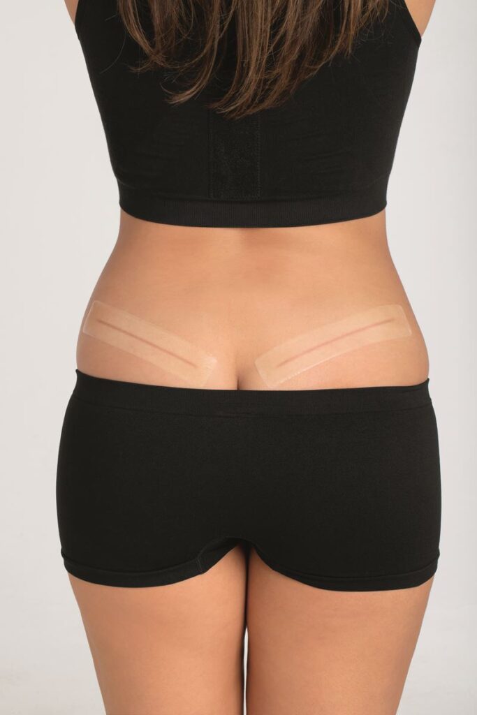 Amoena- 010 Strips Belly/Thigh Silicone Scar Patch Clear