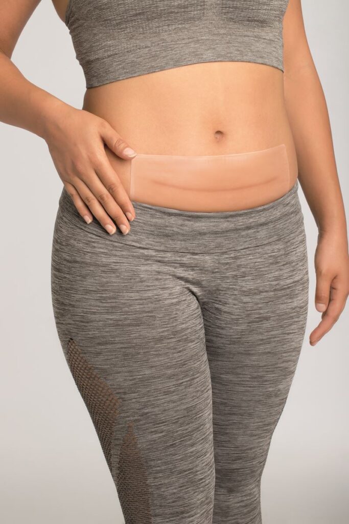 Amoena- 011 Squares Belly/Thigh Silicone Scar Patch Clear